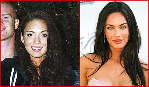 megan fox before and after plastic surgery