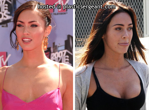 pics of megan fox before plastic surgery. of Megan Fox before and