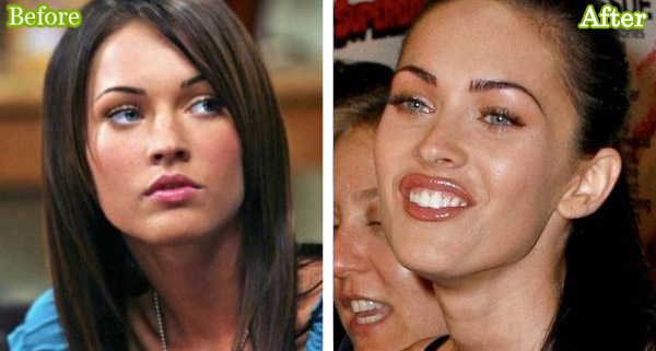 megan fox before and after surgery pictures 2010